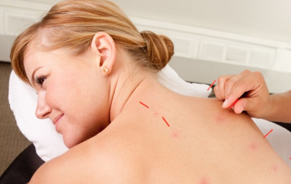 Follow-up Acupuncture Treatment